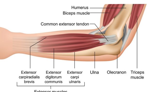 Elbow Diagram