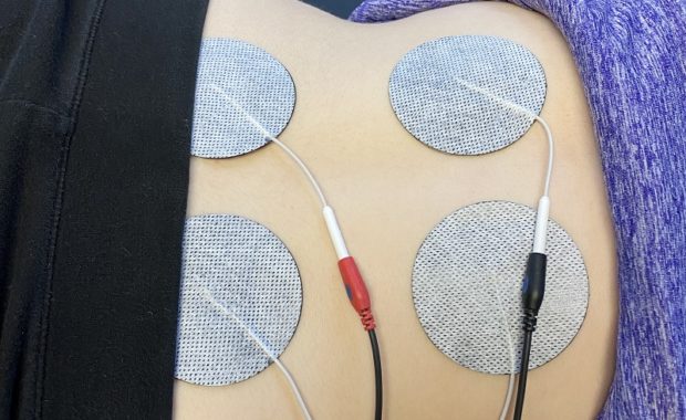 Electrical stimulation pads and leads placed on a patient's lower back