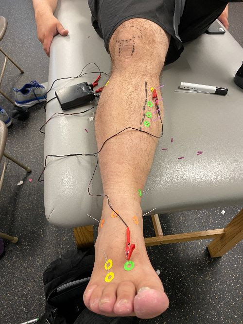 Electrical Muscle Stimulation in Eden Prairie, MN