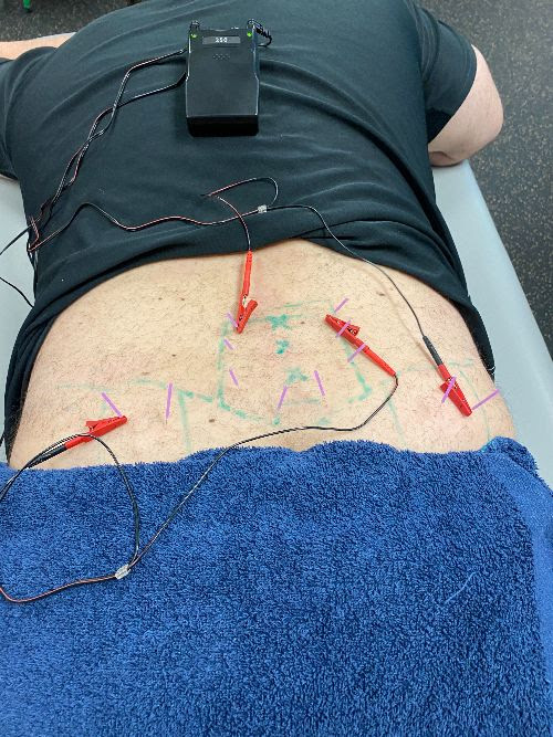 Electrical Muscle Stimulation in Eden Prairie, MN